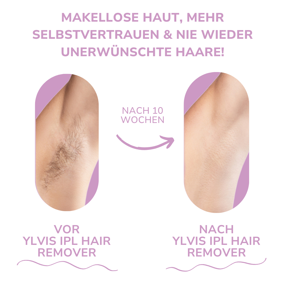 SmoothGlide Hair Remover