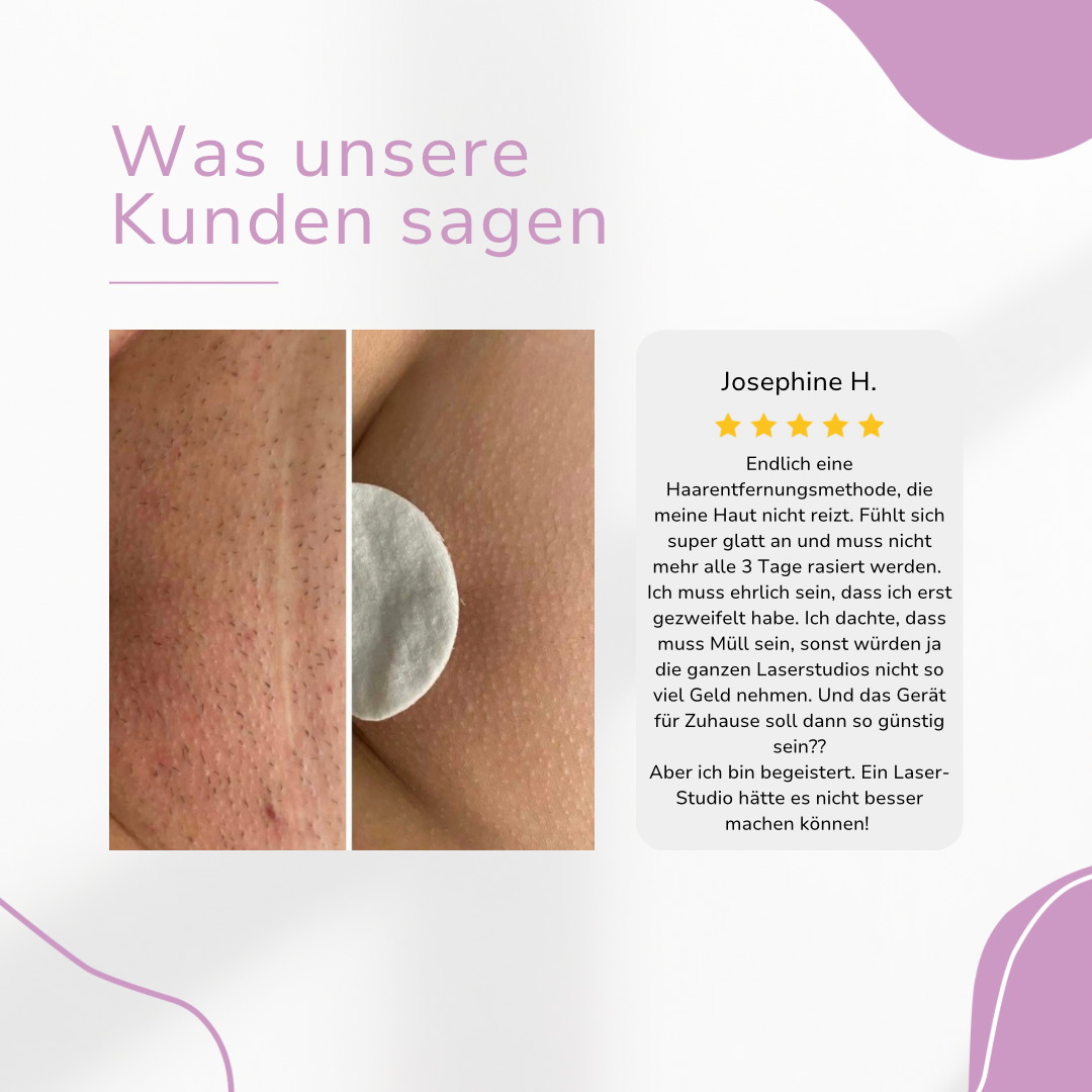 SmoothGlide Hair Remover