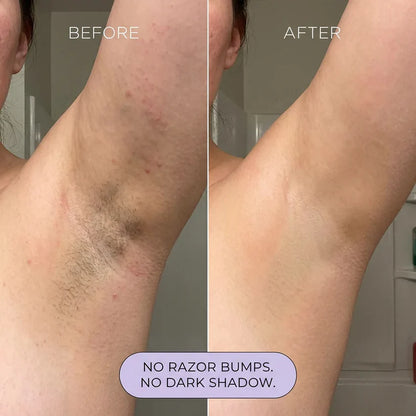 Egomell™ Hair Removal Mousse