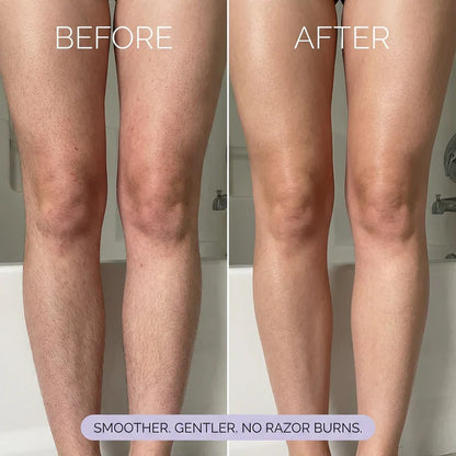 Egomell™ Hair Removal Mousse
