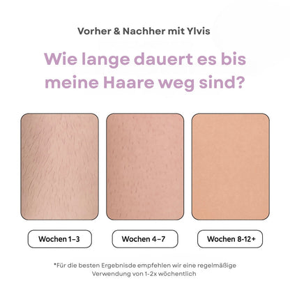 SmoothGlide Hair Remover