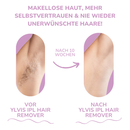 SmoothGlide Hair Remover