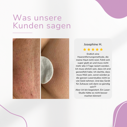 SmoothGlide Hair Remover